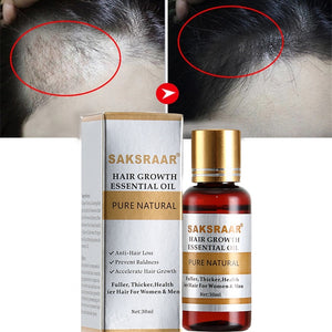 Hair Care Hair Growth Essential Oils Essence Original Authentic 100% Hair Loss Liquid