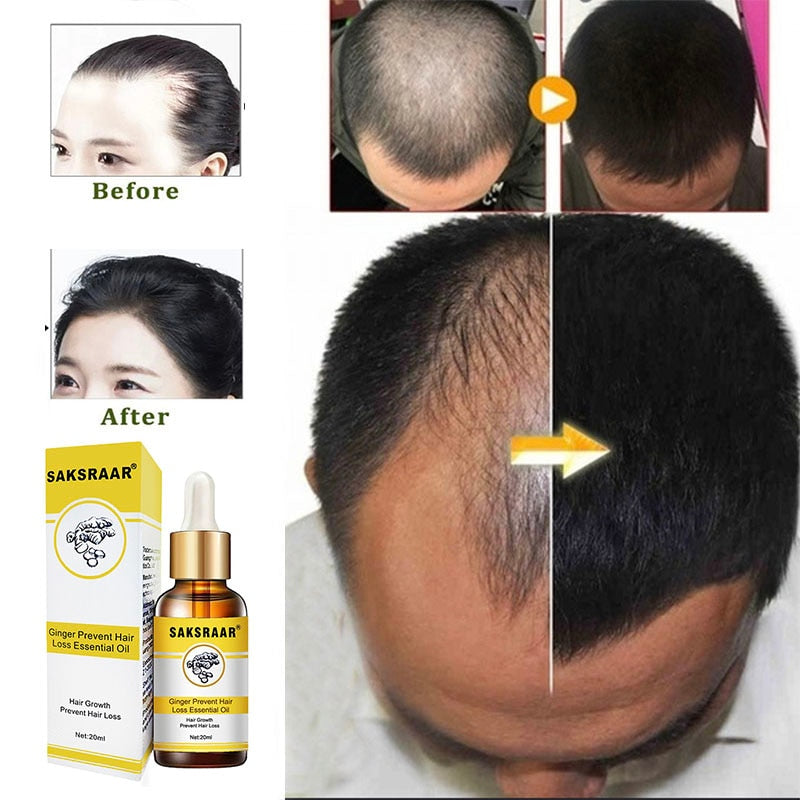 Hair Loss Products Natural With No Side Effects Grow Hair Faster Regrowth